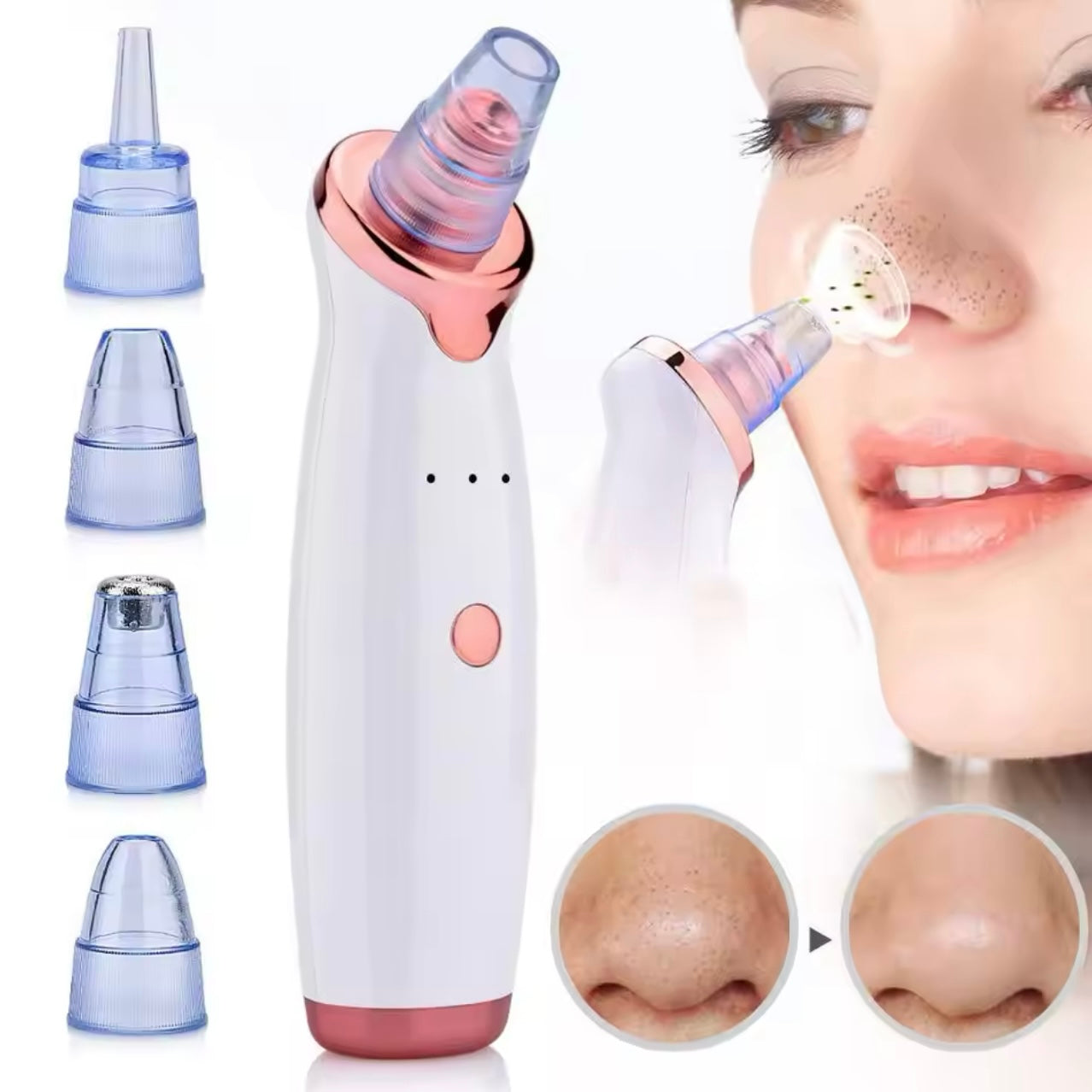 Blackhead Remover Machine- Rechargeable